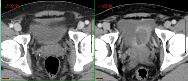 1592561310501058.jpg 0001111.jpg