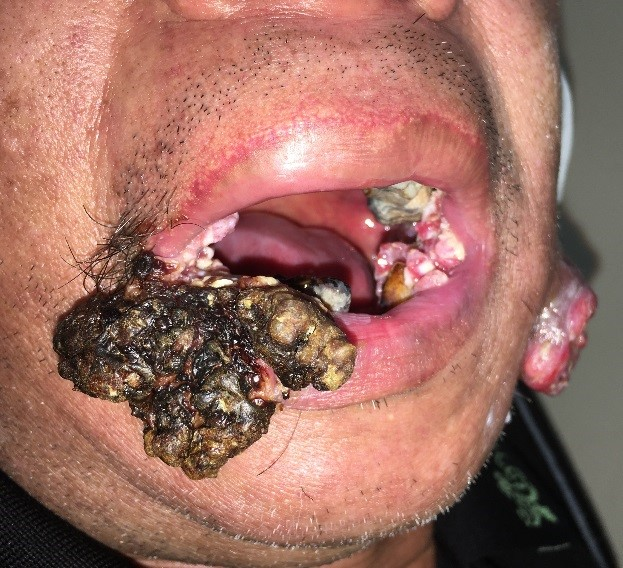 1603100014780098.jpg 1603100014780098.jpg