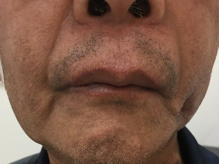 1593757858565457.jpg 1603100096245029.jpg