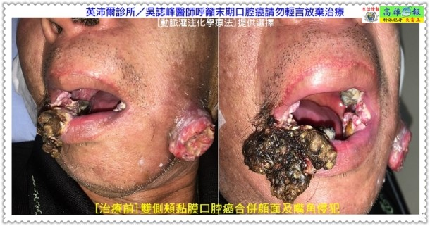 1610517887787693.jpg 05.jpg