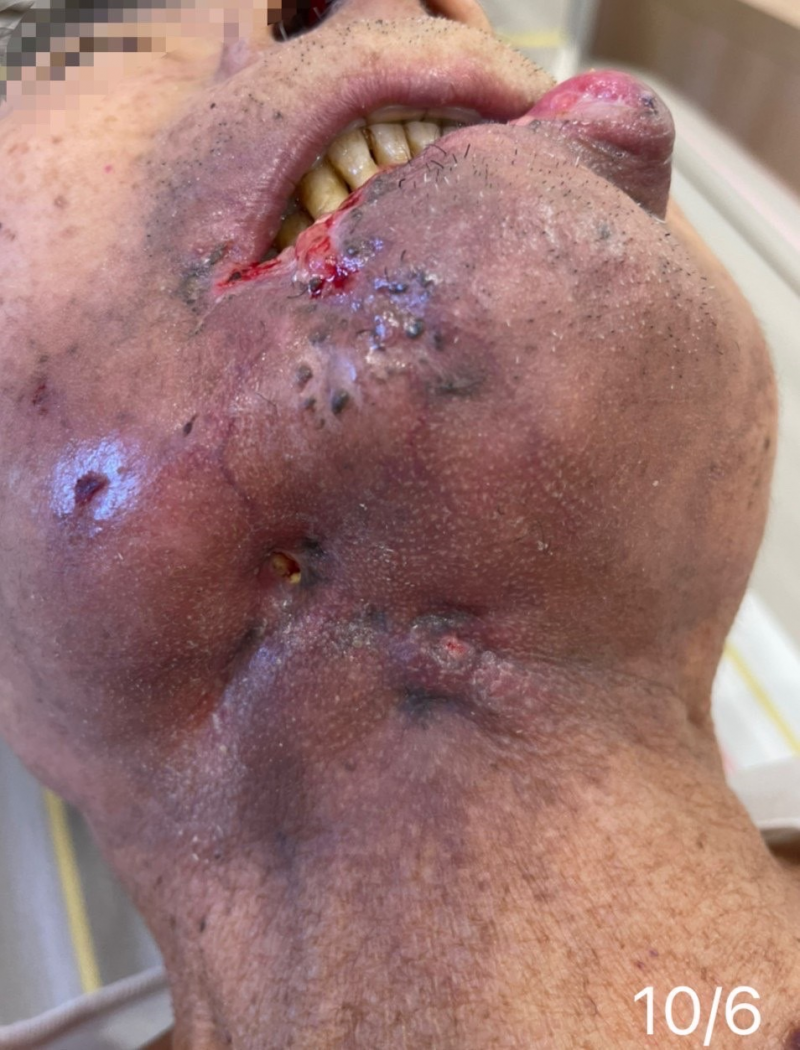 1633508639276169.jpg S__32178523.jpg