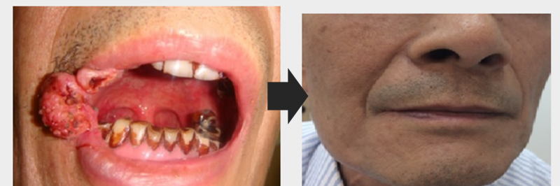 1659518192773733.png Case 1.png