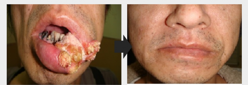 1659518386488864.jpg Case 2.jpg