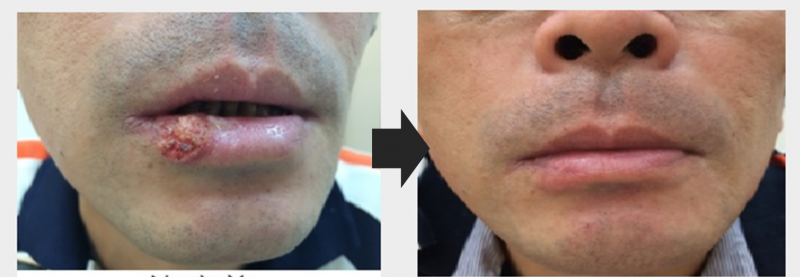 1659518455426583.png Case 3.png