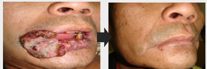 1659518533601724.jpg Case 5.jpg