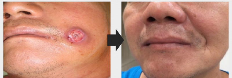 1659518594921229.png Case 6.png